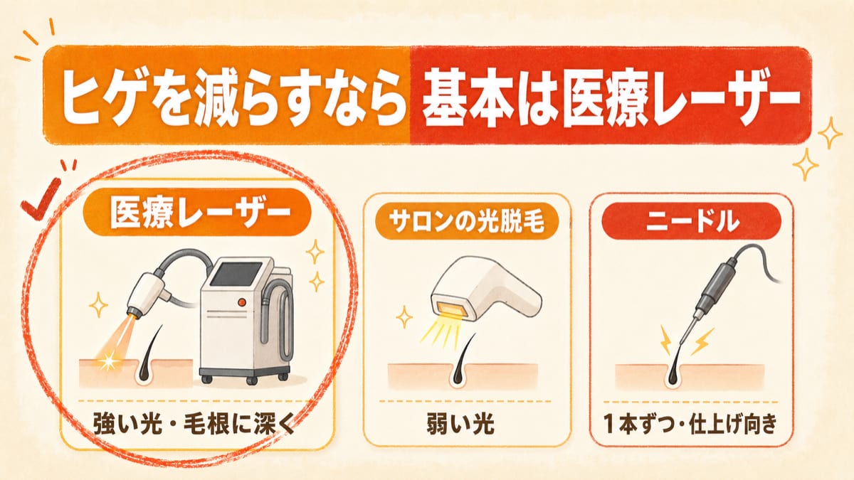 ヒゲ脱毛の3つの方法を比べ、毛根に深く届く医療レーザーを基本に選ぶことを示した図