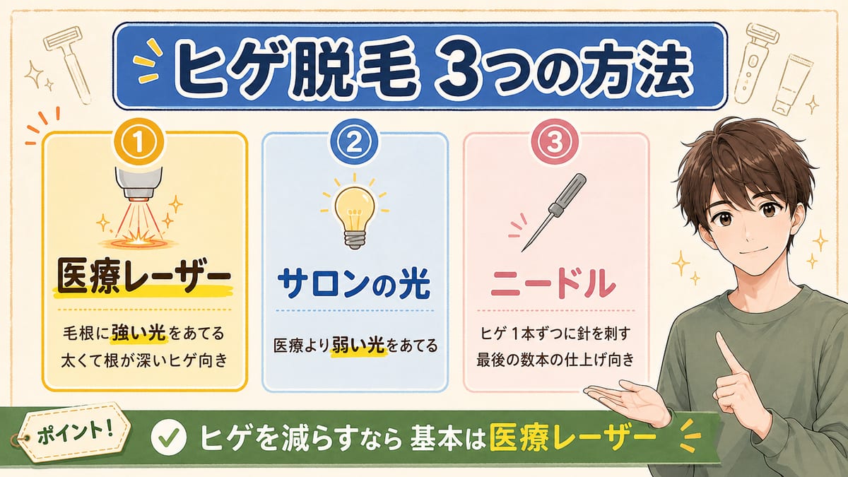 ヒゲ脱毛の医療レーザー・サロンの光・ニードルの3つの方法を比べ、基本は医療レーザーを選ぶとまとめた図