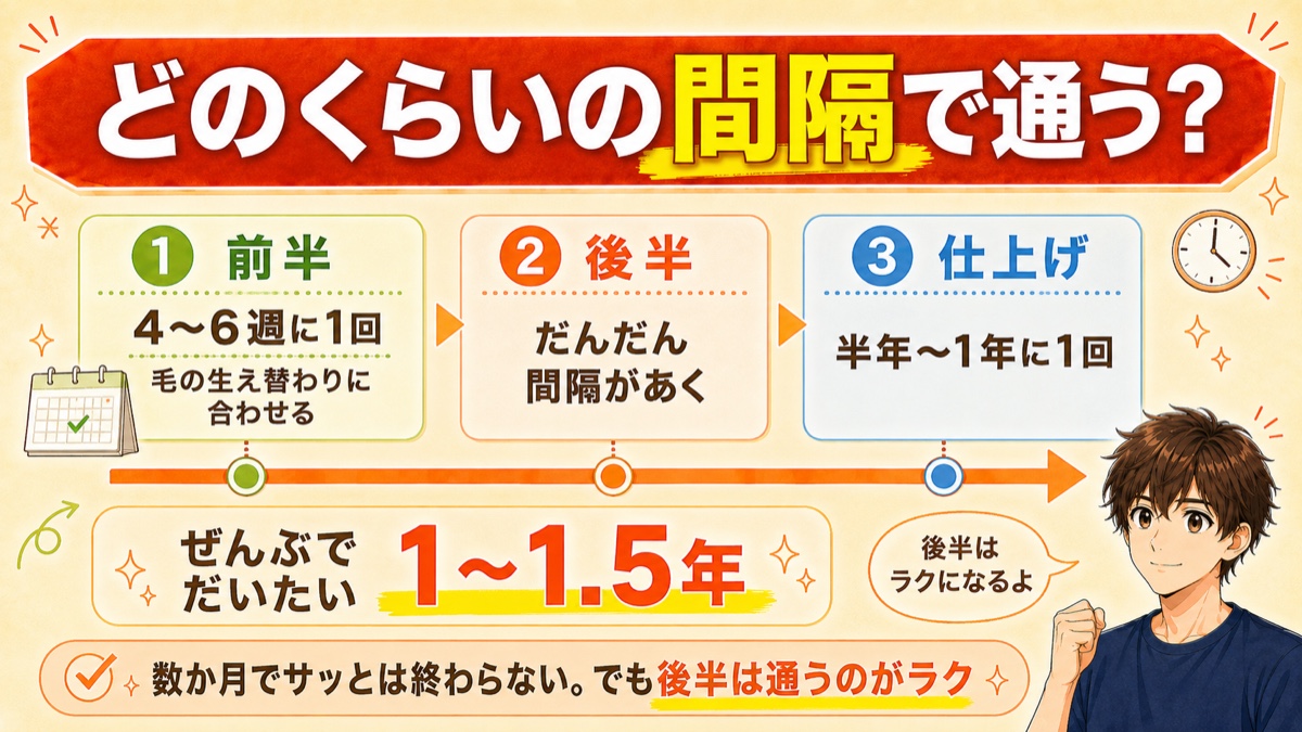 ヒゲ脱毛に通う間隔と期間の目安（前半4〜6週・仕上げは年1〜数回・全体1〜1.5年）を示したタイムライン図