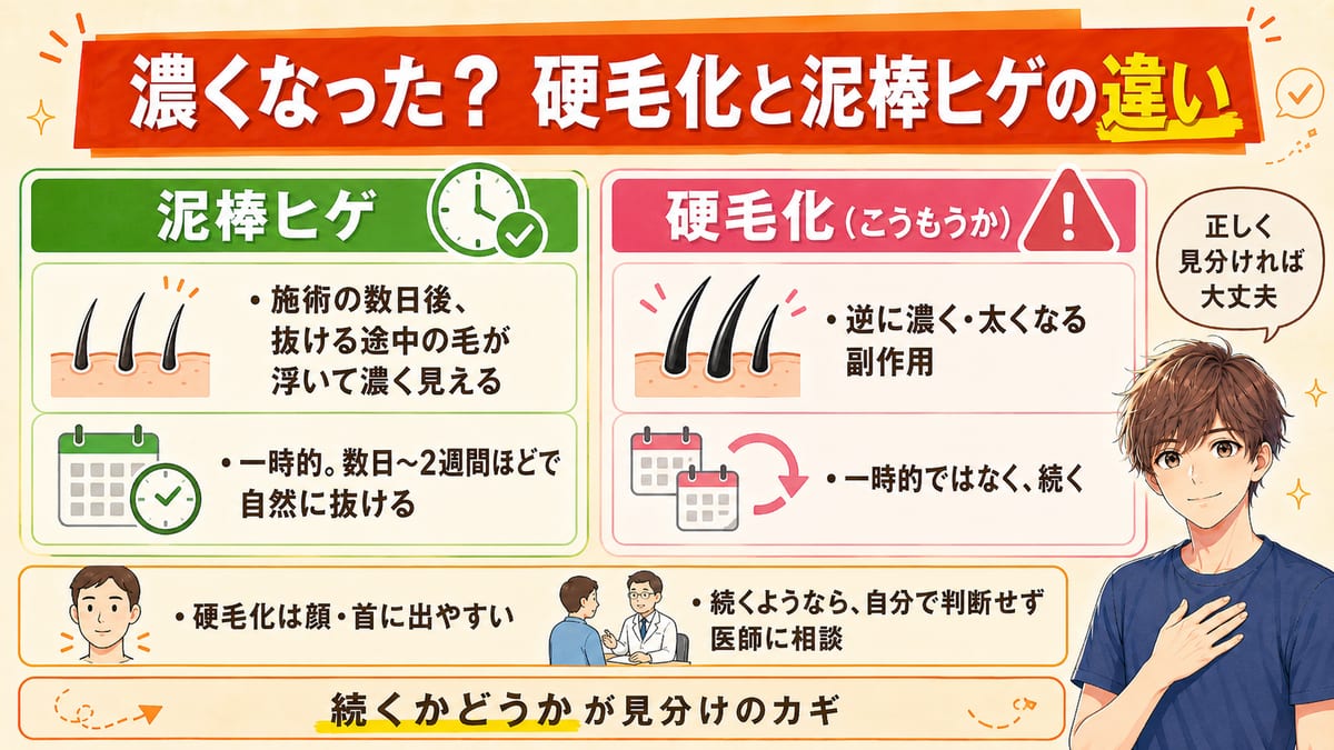 施術後に濃くなったとき、一時的な泥棒ヒゲと続く硬毛化の違いを左右で見比べた図。泥棒ヒゲは数日〜2週間で抜ける、硬毛化は続く副作用で顔・首に出やすいとまとめている